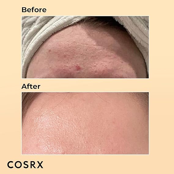 COSRX Advanced Snail 96 Mucin Power Essence 100ml, Skin Repair & Hydrating Serum, Snail Secretion Filtrate 96% & Hyaluronic acid, Korean Skincare, Animal testing free